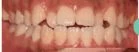 before_image