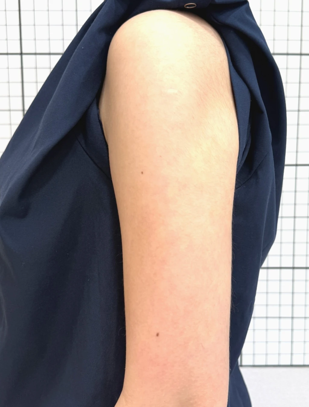 before_image