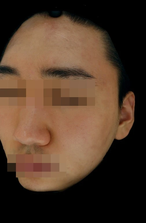 before_image