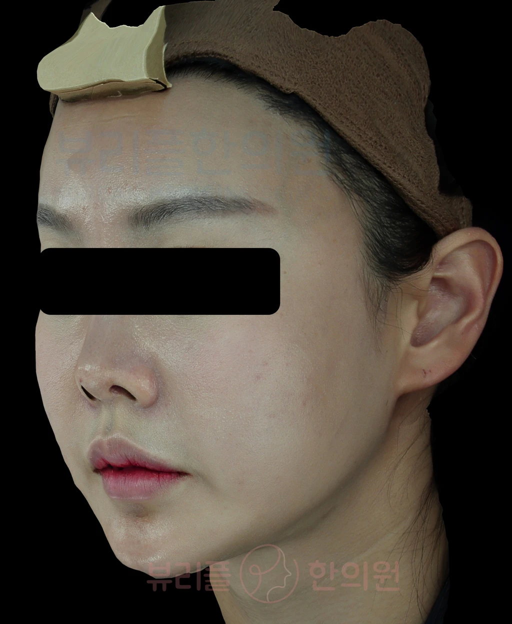 before_image