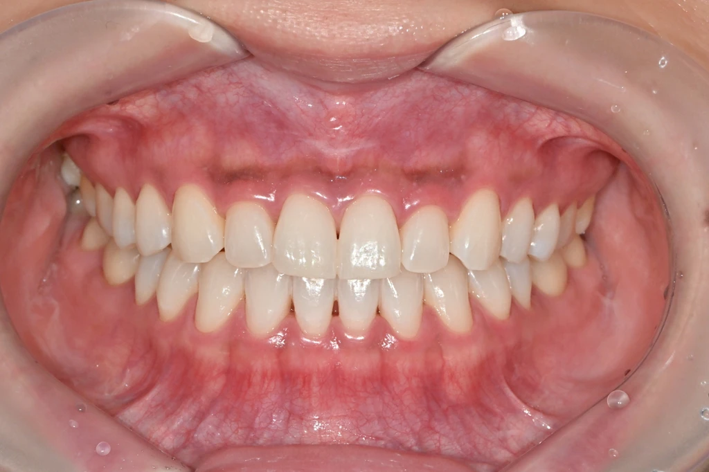 before_image