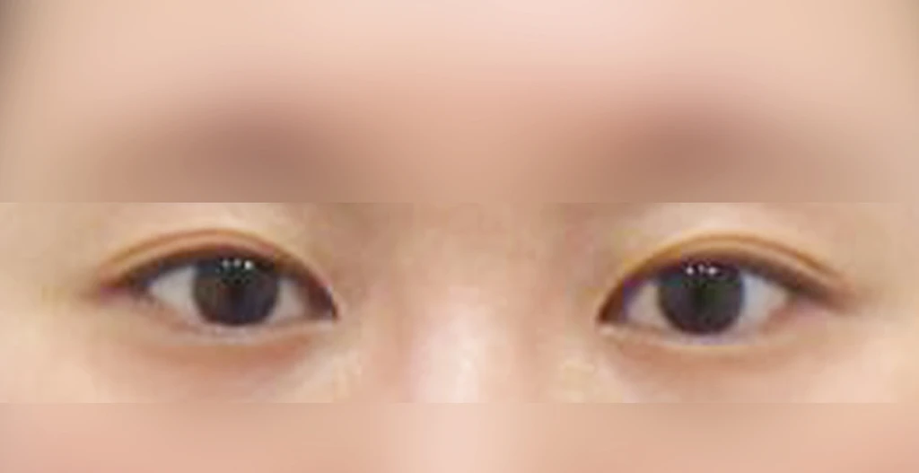 before_image