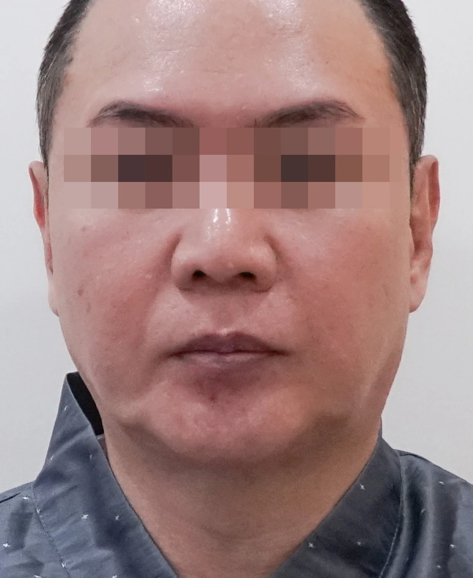 before_image