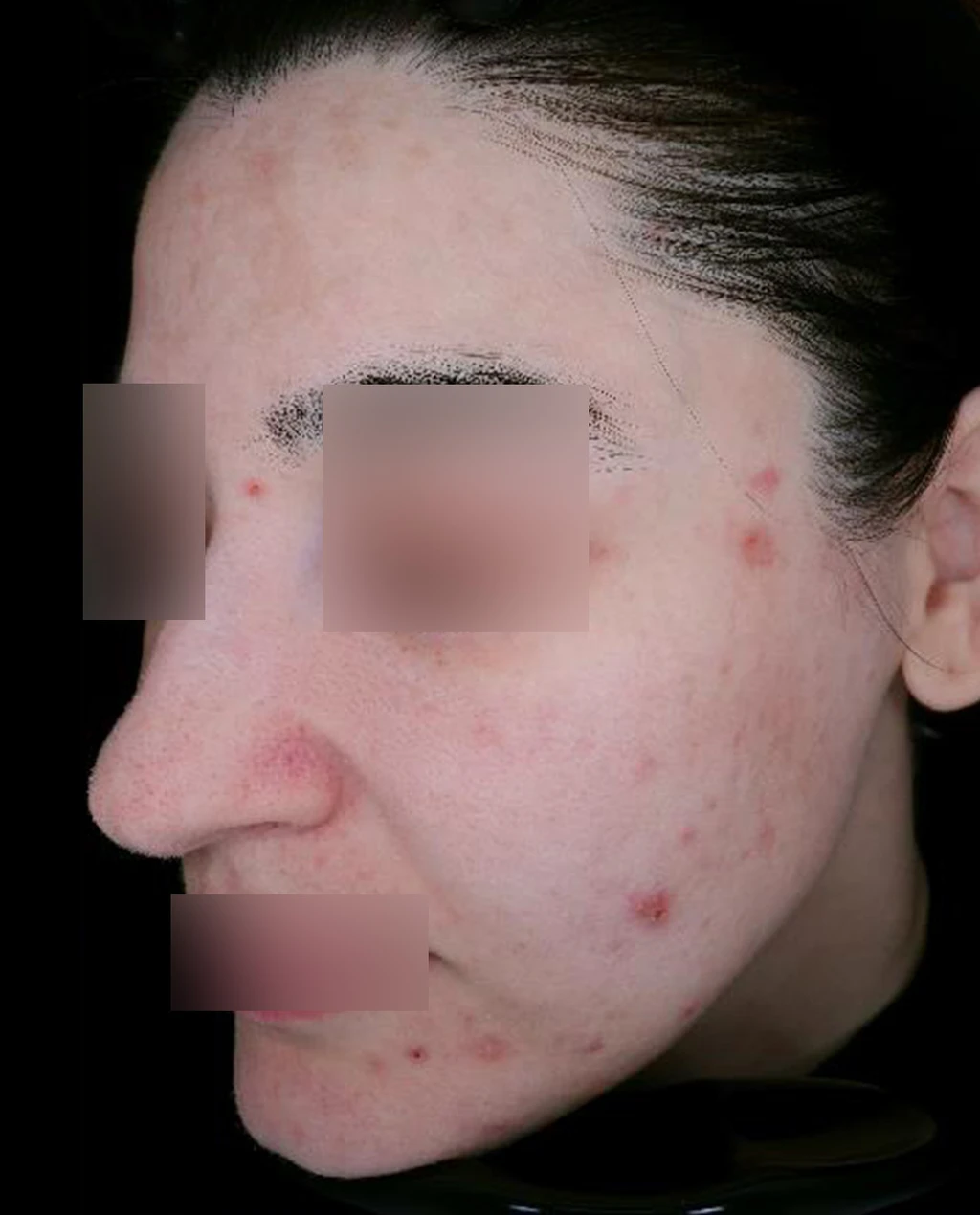 before_image
