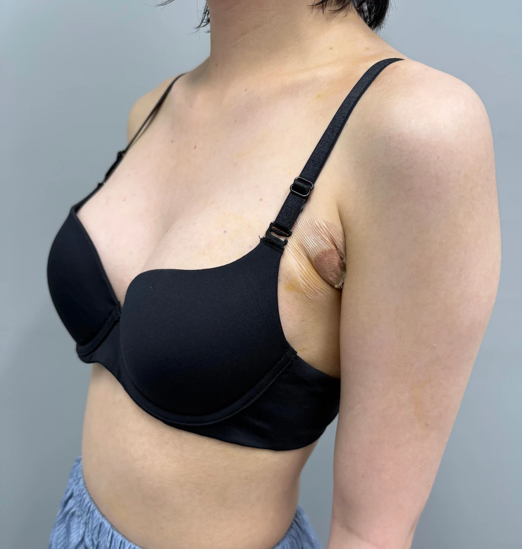 before_image