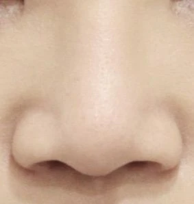 before_image