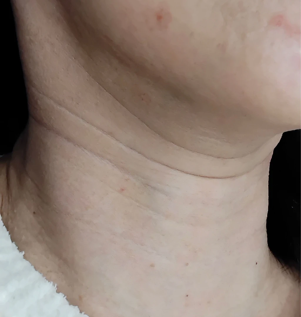 before_image