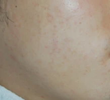before_image