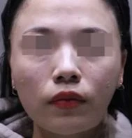 before_image