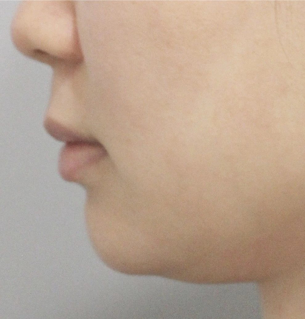 before_image