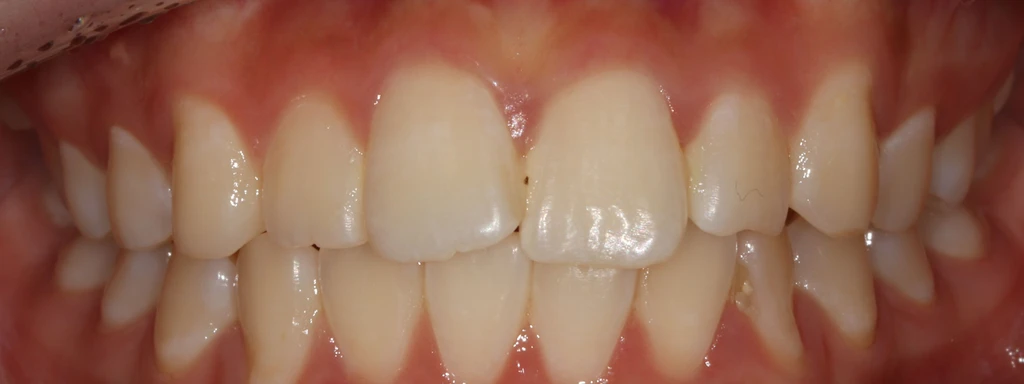 before_image