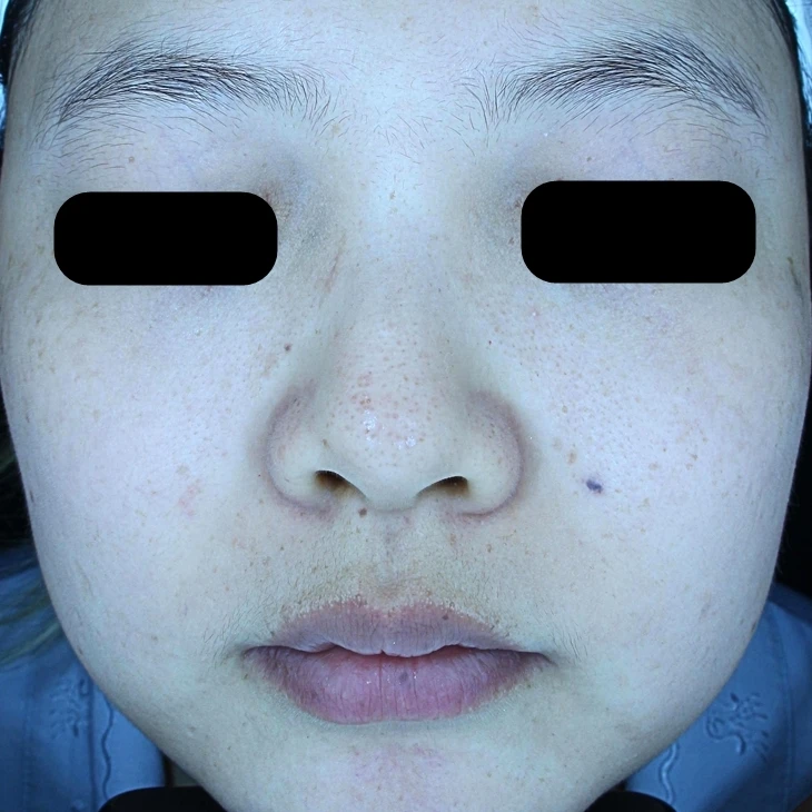 before_image