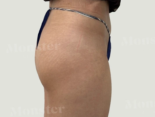 before_image