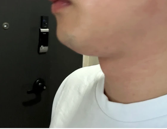 before_image