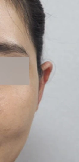 before_image