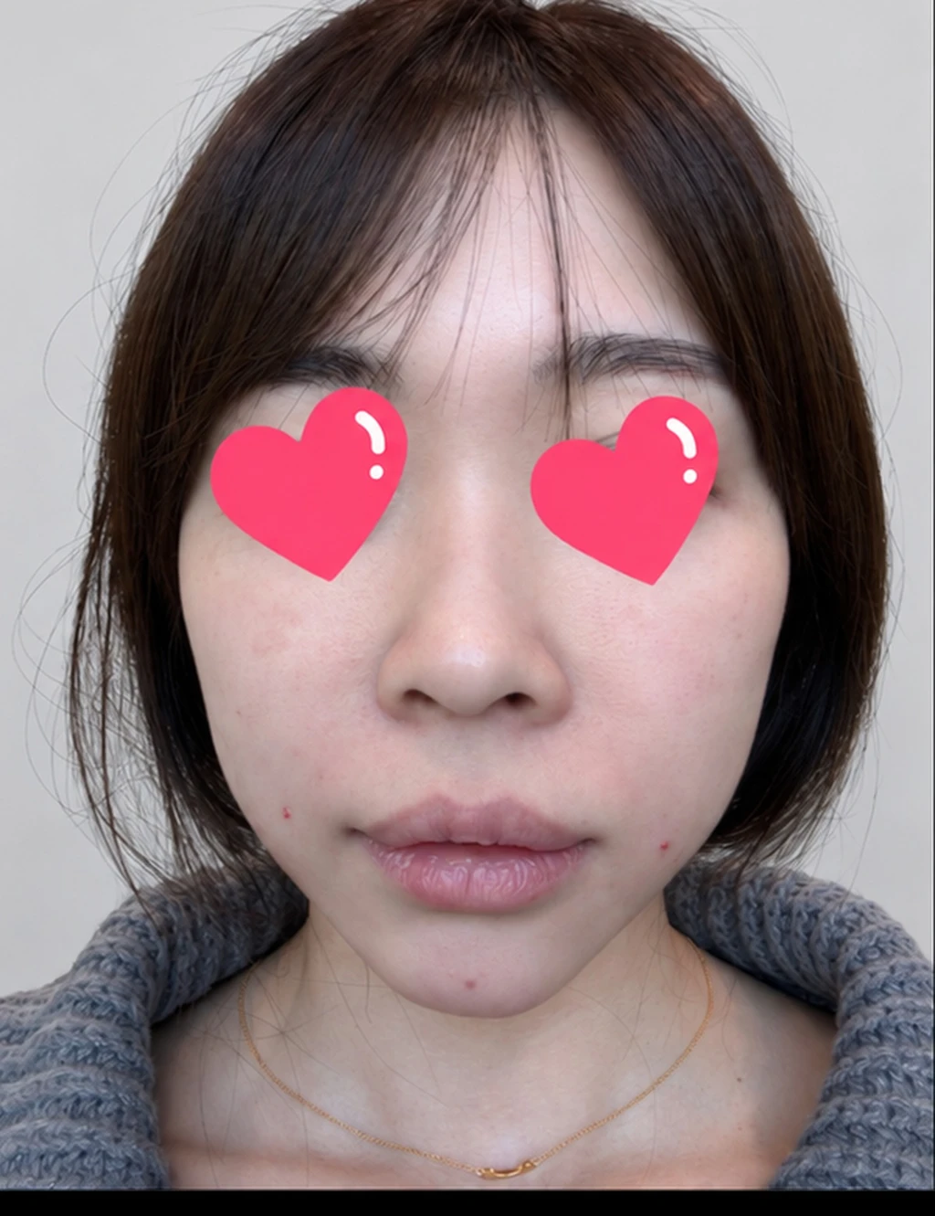 before_image