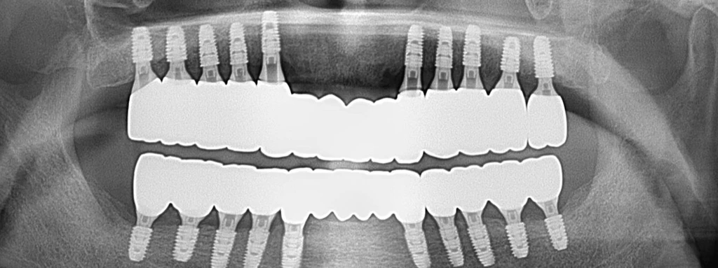 before_image