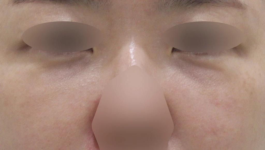 before_image