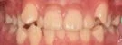 before_image