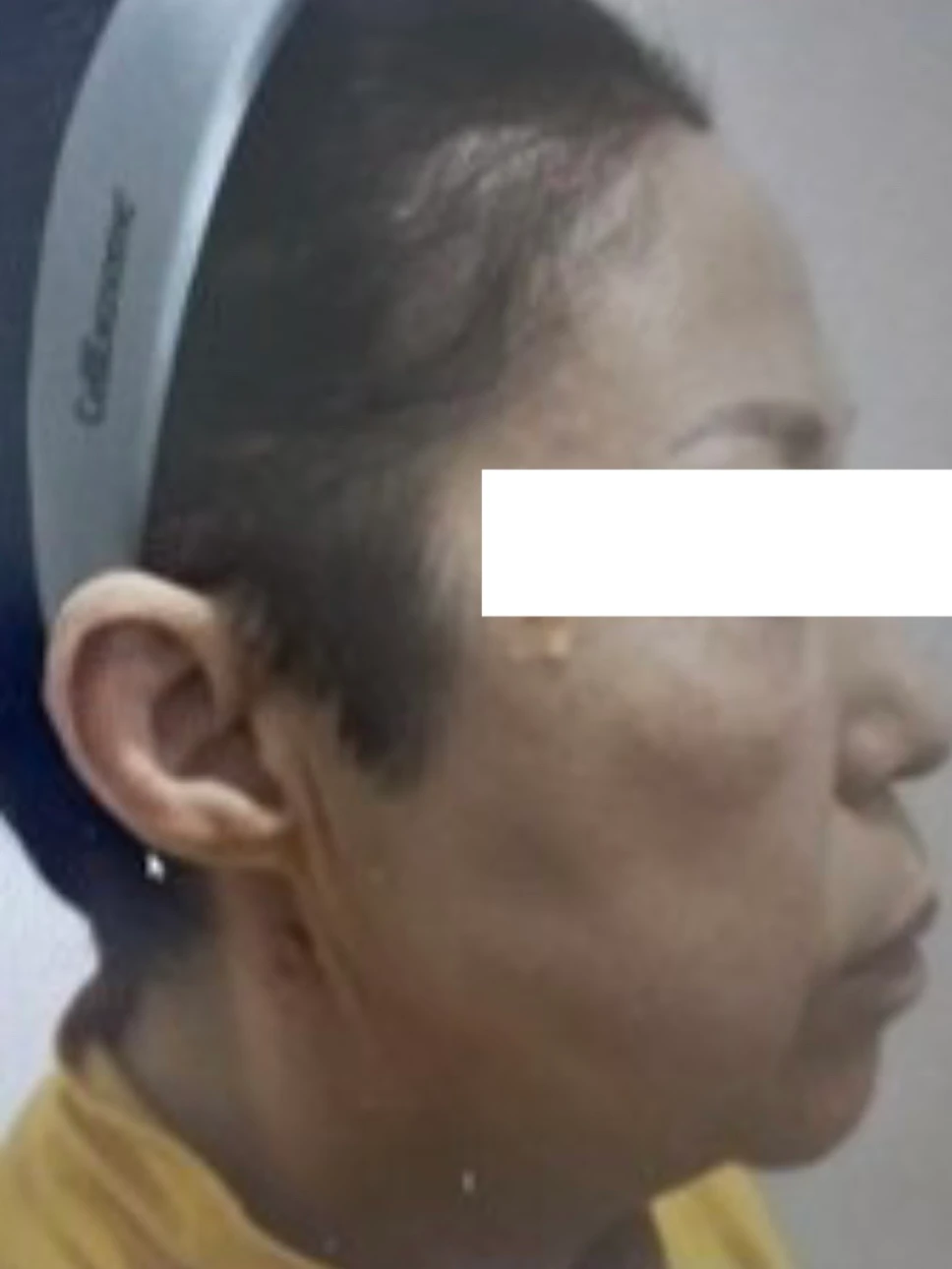 before_image