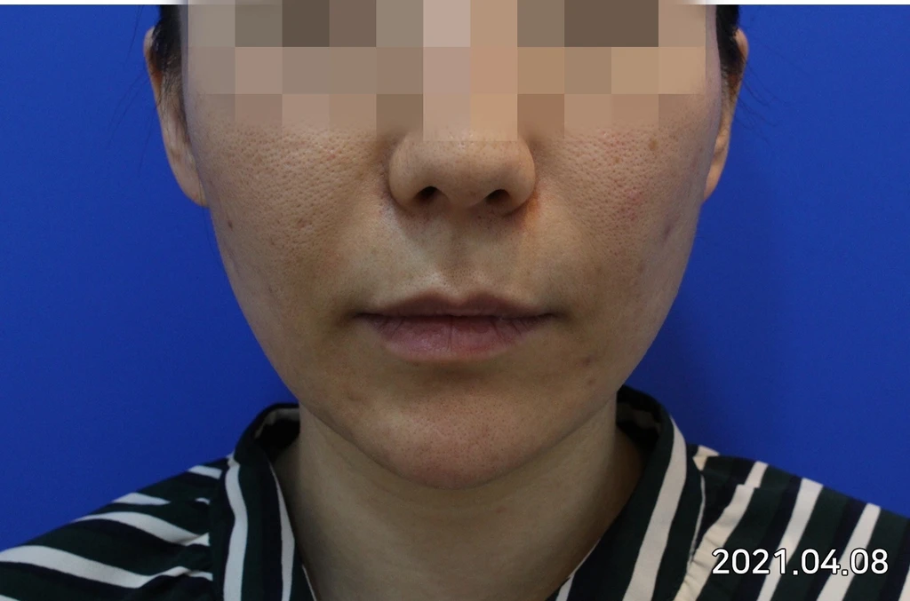 before_image