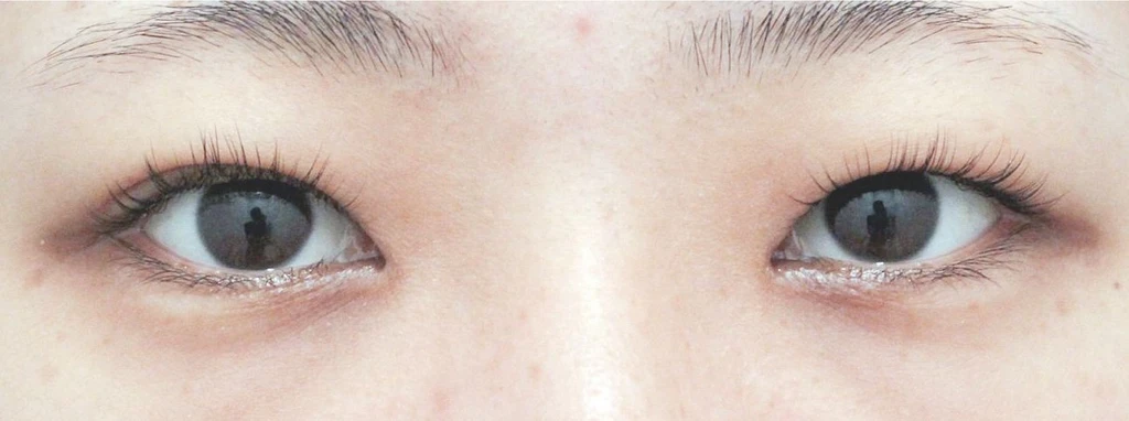 before_image