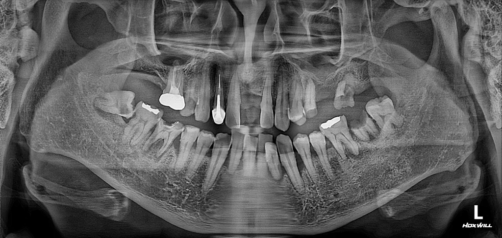 before_image