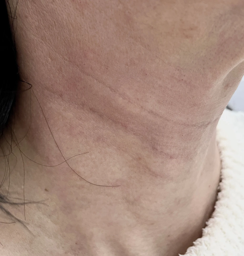 before_image