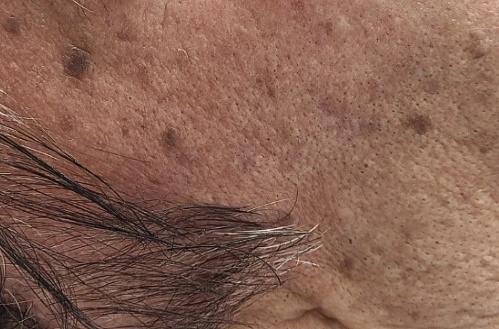 before_image