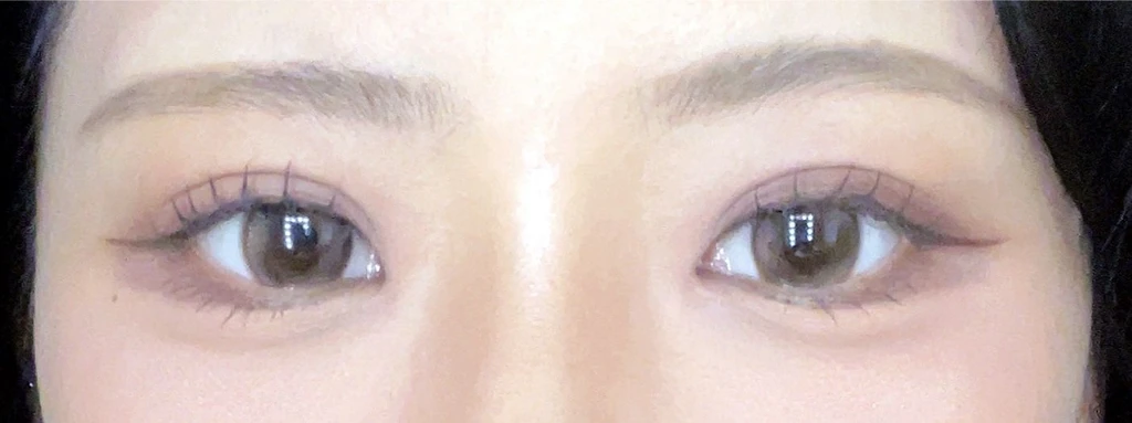 before_image