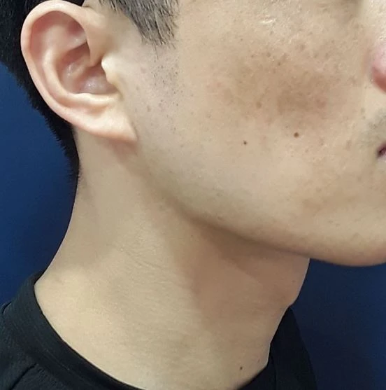 before_image