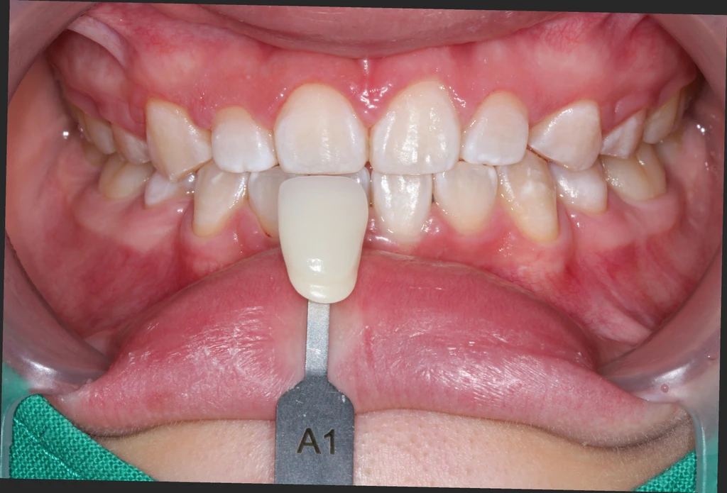before_image