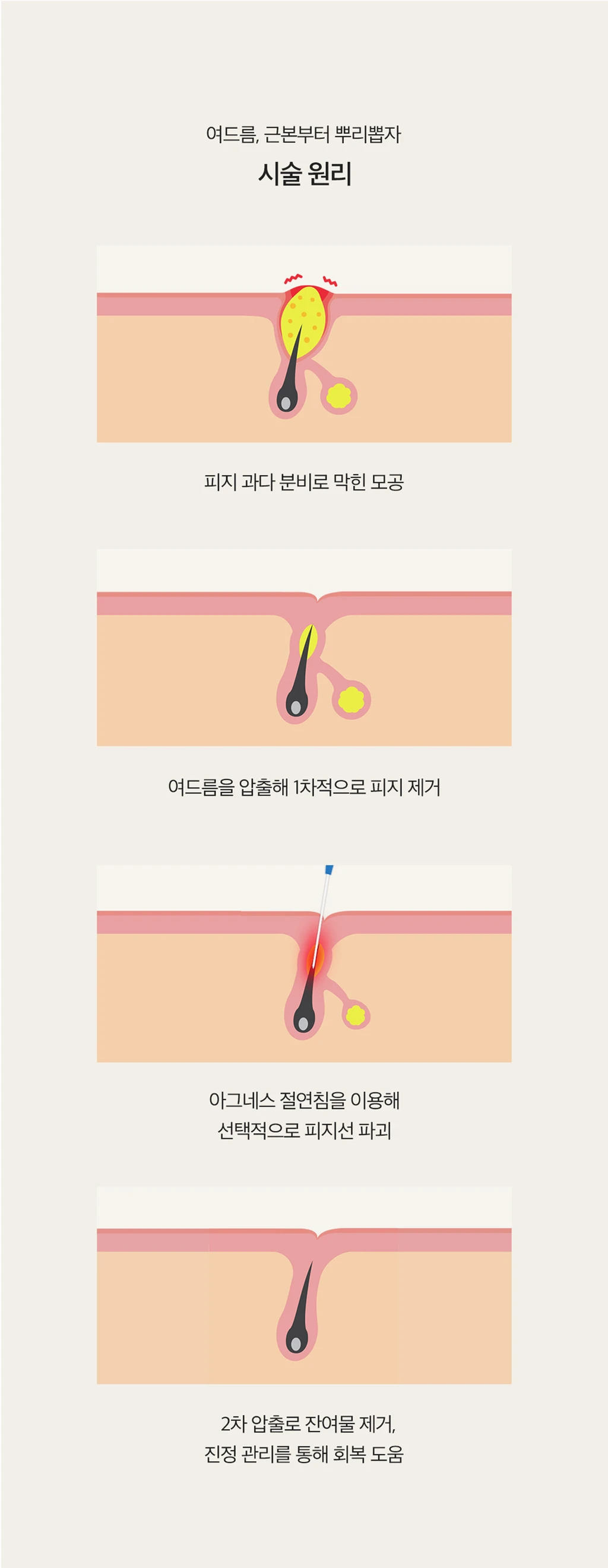treatmentIntroduction