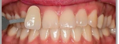before_image