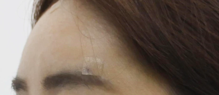 before_image