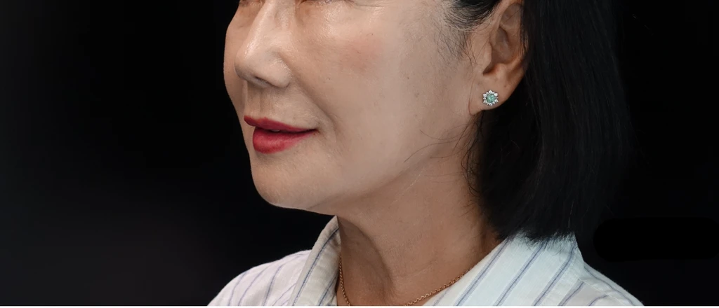 before_image