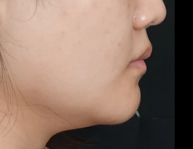 before_image