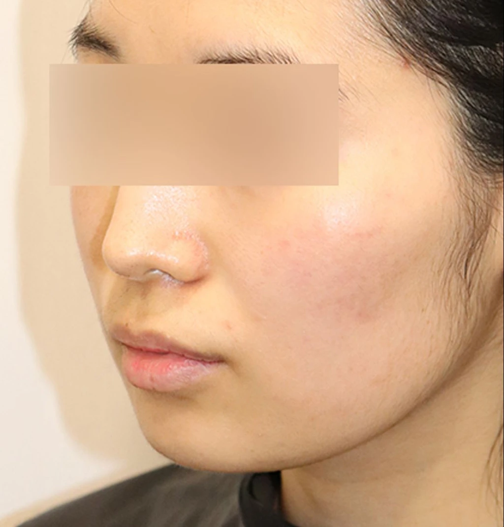 before_image