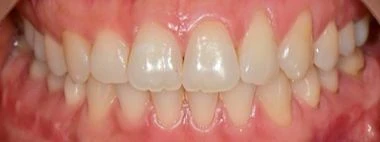 before_image