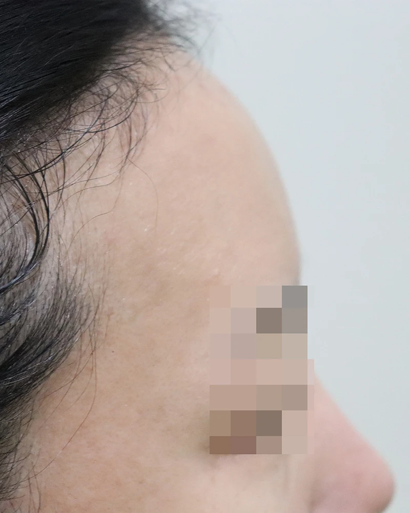 before_image