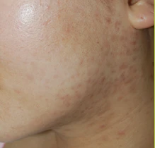 before_image