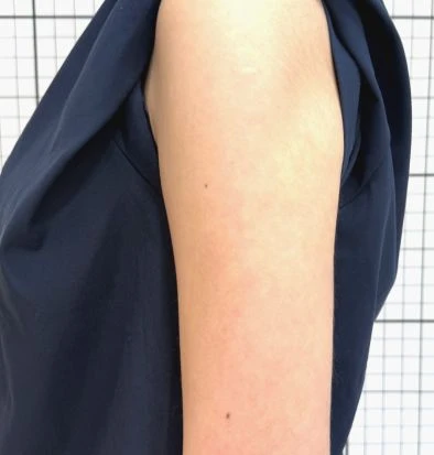 before_image