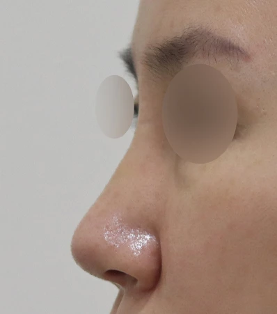 before_image