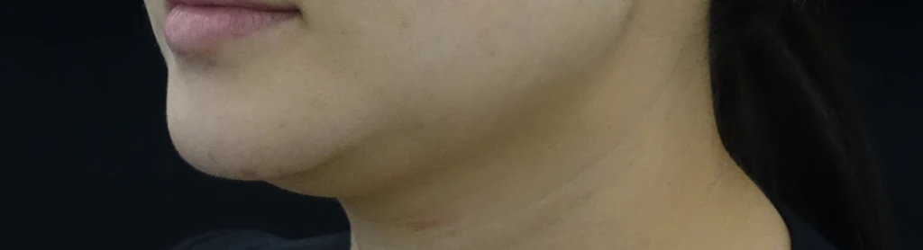 before_image