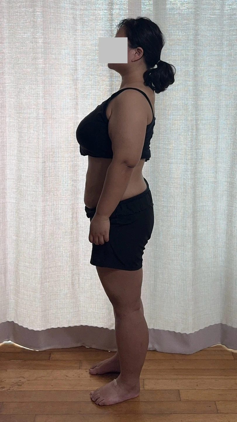 before_image
