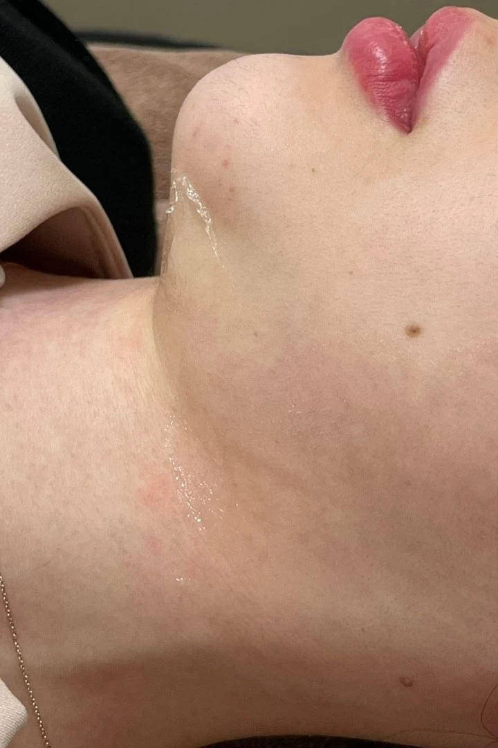 before_image