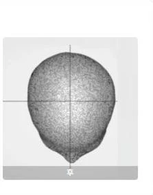 before_image