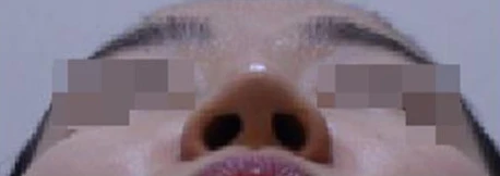 before_image