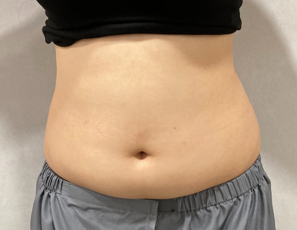 before_image