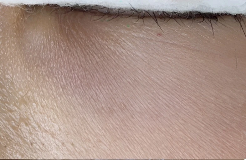 before_image
